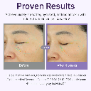 Centellian24 360º Shot PDRN Active Serum 50ml